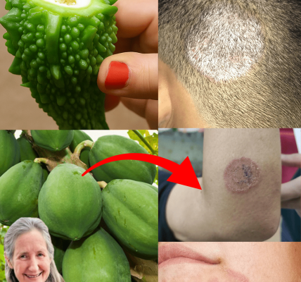 9 Ultimate Home Remedies to Eradicate Fungal Infections Fast and Naturally – dogpjs.com – Health