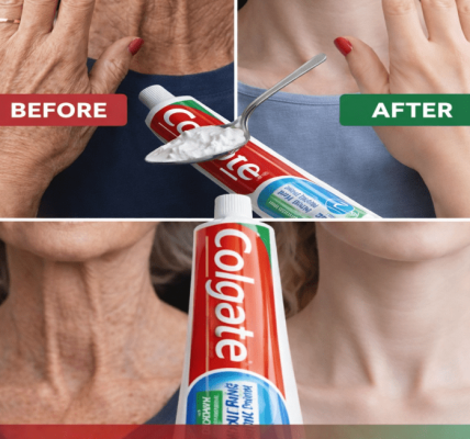 The Simple Lemon Hand Ritual That May Brighten and Smooth Aging Skin – Healthy Life