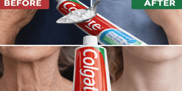 The Simple Lemon Hand Ritual That May Brighten and Smooth Aging Skin – Healthy Life