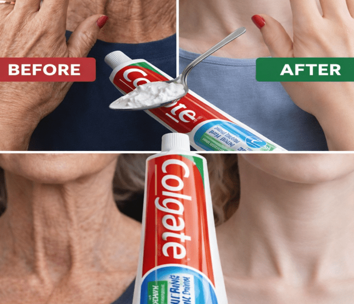 The Simple Lemon Hand Ritual That May Brighten and Smooth Aging Skin – Healthy Life