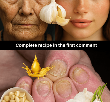 How a Simple Garlic Mask Can Reignite Your Collagen and Smooth Fine Lines at Any Age – Health