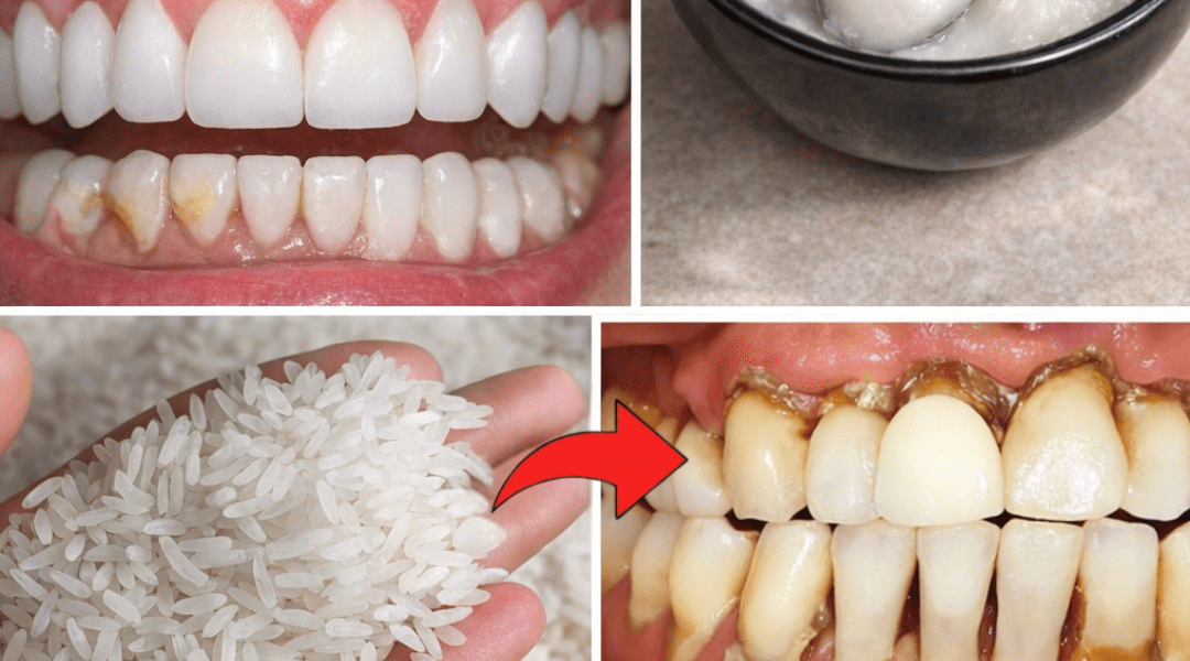 How to Naturally Brighten Your Smile and Reduce Tartar Buildup at Home – Health