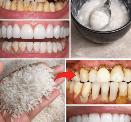How to Naturally Brighten Your Smile and Reduce Tartar Buildup at Home – Health