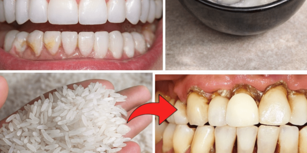 How to Naturally Brighten Your Smile and Reduce Tartar Buildup at Home – Health