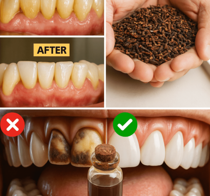 9 Natural Secrets to Erase Plaque and Tartar Buildup (Your Dentist Won’t Tell You!) – Health