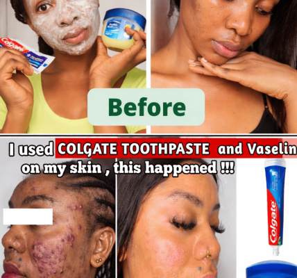 What Happens When You Apply Toothpaste and Vaseline to Your Face? A Closer Look at This Viral Trend – Health