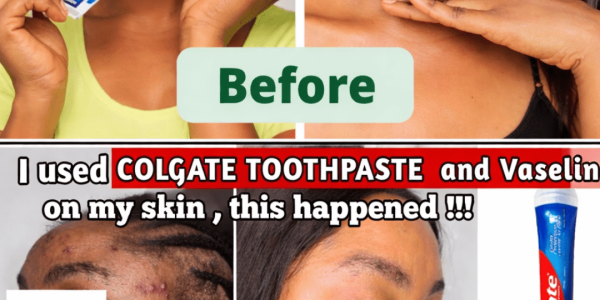 What Happens When You Apply Toothpaste and Vaseline to Your Face? A Closer Look at This Viral Trend – Health