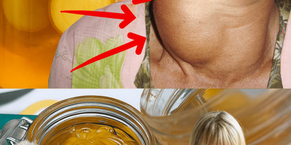 Natural Turmeric & Honey Formula to Support Thyroid Health – Inspired by Barbara O’Neill – dogpjs.com – Health