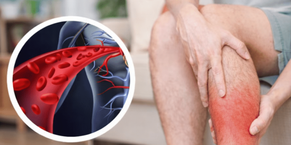 One vitamin that opens blood vessels and improves circulation – Health