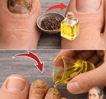 Insights on Home Options and When to Seek Help – Health