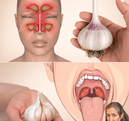 How Can Garlic Offer Natural Support for Urinary Tract Comfort and Overall Wellness? – Health