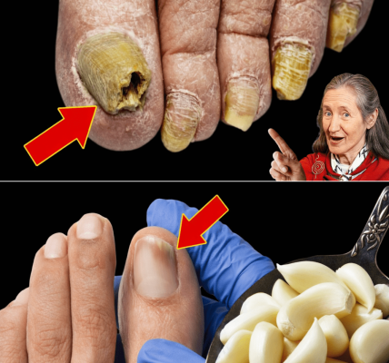 The Garlic Trick That Could Help Restore Your Toenail Health – Health
