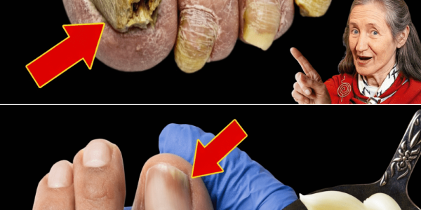 The Garlic Trick That Could Help Restore Your Toenail Health – Health