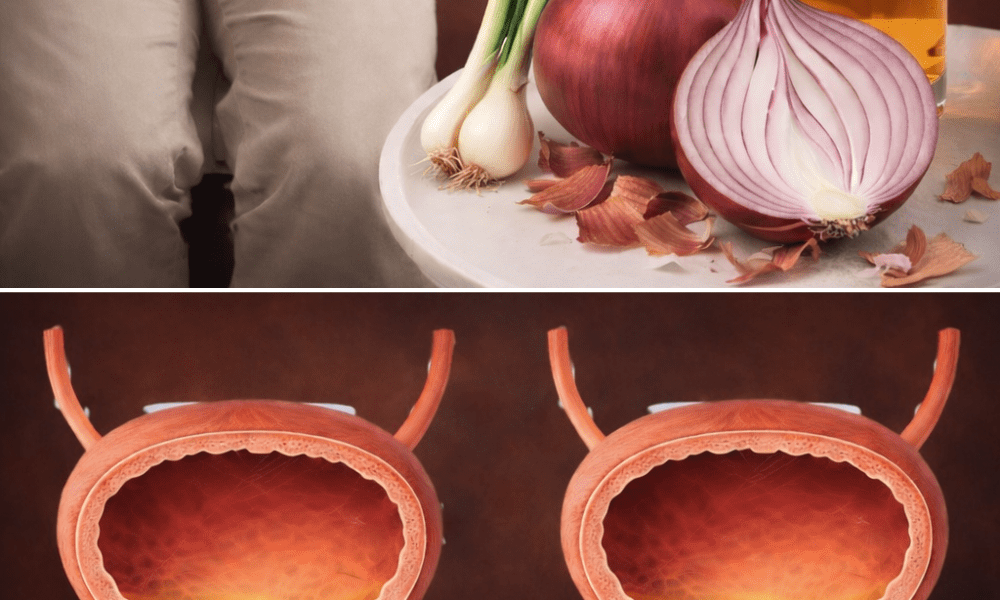 Drink This Onion Peel Tea Before Bed – What Happens to Your Prostate and Bladder Will Surprise You – Health
