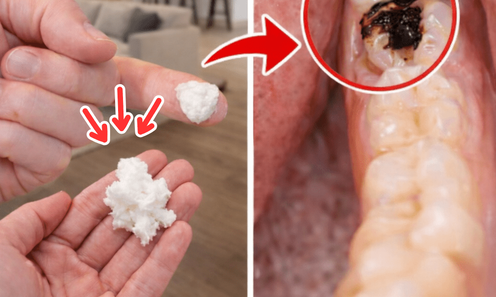 5 Powerful Home Remedies That May Help Prevent Cavities and Reduce Dental Visits – Health