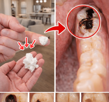 5 Powerful Home Remedies That May Help Prevent Cavities and Reduce Dental Visits – Health