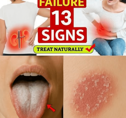 13 Early Signs of Kidney Failure (You Ignore Daily)