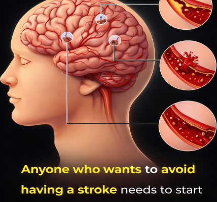 Want to Help Reduce Your Risk of Stroke? Try Adding These 15 Foods to Your Meals Today – Health