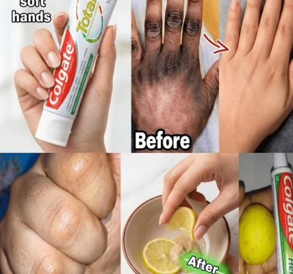 The Lemon + Sugar + Coffee Hand Mask That Makes Hands Look Younger – Healthy Life