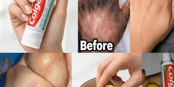 The Lemon + Sugar + Coffee Hand Mask That Makes Hands Look Younger – Healthy Life