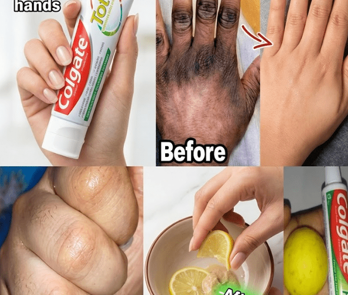 The Lemon + Sugar + Coffee Hand Mask That Makes Hands Look Younger – Healthy Life