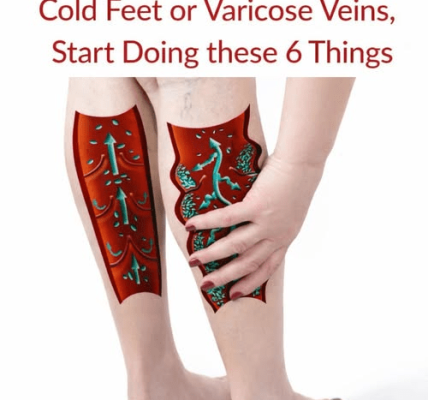 If You Have Poor Circulation, Cold Feet or Varicose Veins, Start Doing These 6 Things – Health