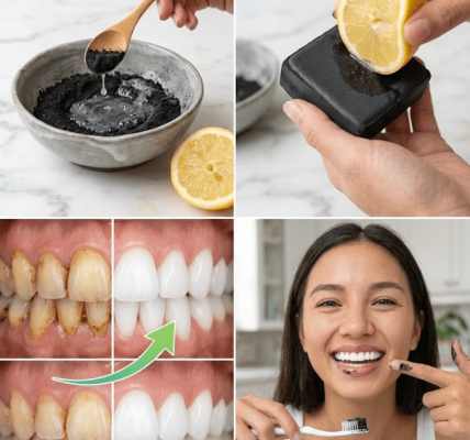 Charcoal, Lemon, and the Truth About Whitening Your Teeth – Healthy Life