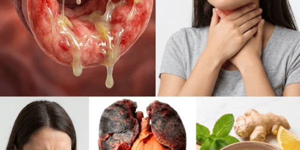 A Gentle Way to Soothe Throat Mucus – Healthy Life