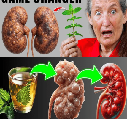 5 Powerful Herbs That May Support Kidney Detox Naturally – Healthy Life