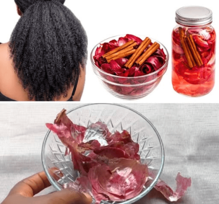 Don’t Throw Onion Peels Away! The Surprising Cinnamon Mix That May Double Your Hair Growth Efforts – healthtips