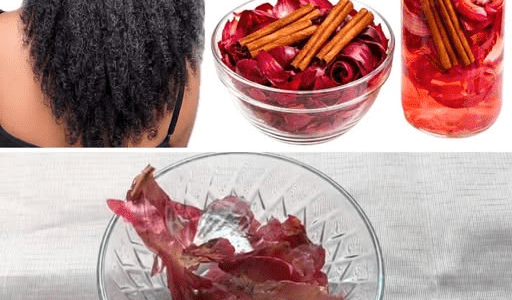 Don’t Throw Onion Peels Away! The Surprising Cinnamon Mix That May Double Your Hair Growth Efforts – healthtips