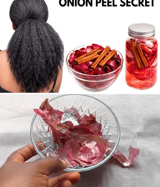 Don’t Throw Onion Peels Away! The Surprising Cinnamon Mix That May Double Your Hair Growth Efforts – healthtips