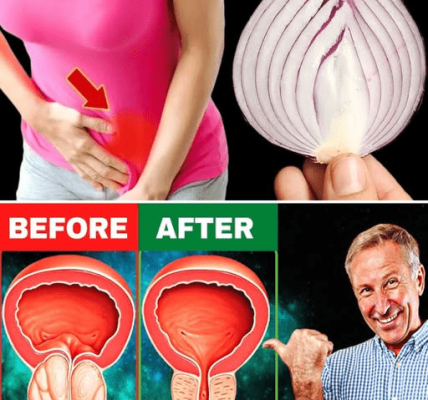 Drink This Onion Peel Tea Before Bed – What Happens to Your Prostate and Bladder Will Surprise You – Healthy Life!