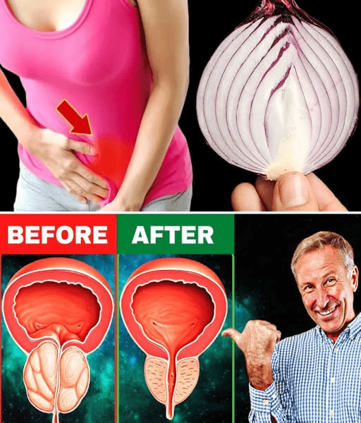 Drink This Onion Peel Tea Before Bed – What Happens to Your Prostate and Bladder Will Surprise You – Healthy Life!