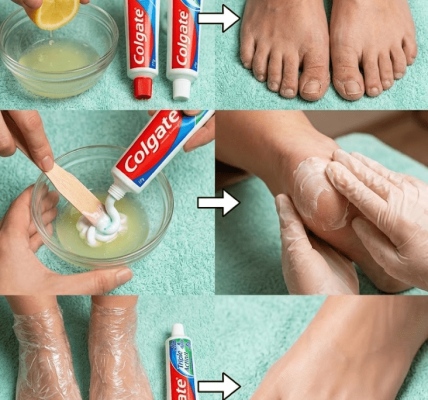 The Unexpected Toothpaste Trick for Softer Feet – Healthy Life