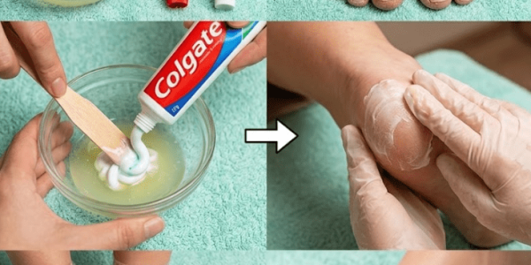 The Unexpected Toothpaste Trick for Softer Feet – Healthy Life