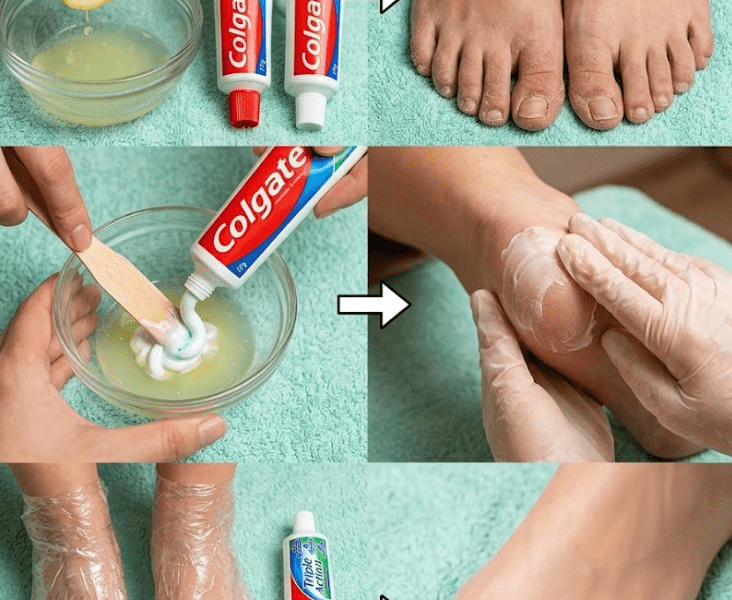 The Unexpected Toothpaste Trick for Softer Feet – Healthy Life