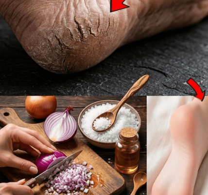 5 Natural Remedies That May Help Heal Cracked Heels – Healthy Life