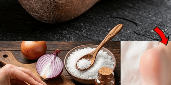 5 Natural Remedies That May Help Heal Cracked Heels – Healthy Life