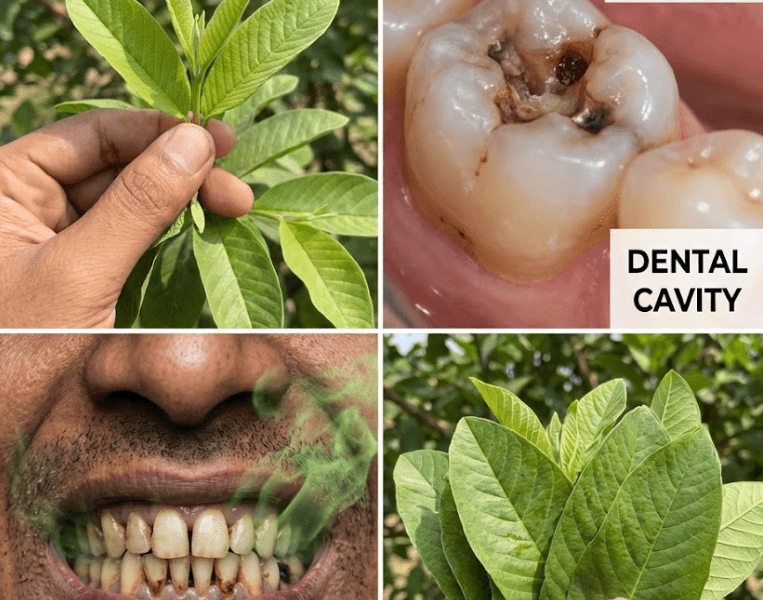 3 Genius Guava Leaf Habits for a Cleaner Mouth and Healthier Teeth – Healthy Life