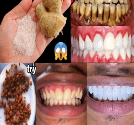 The Surprising Garlic Trick for Stronger Teeth and Healthier Gums – Healthy Life