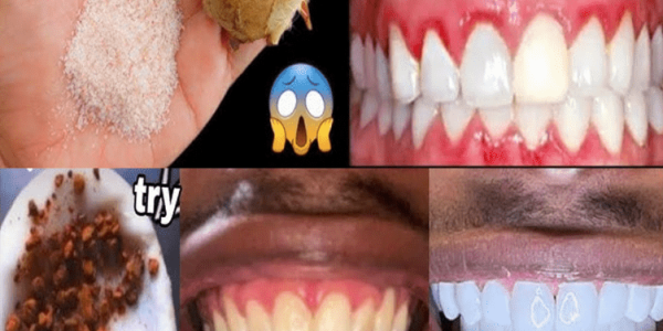 The Surprising Garlic Trick for Stronger Teeth and Healthier Gums – Healthy Life