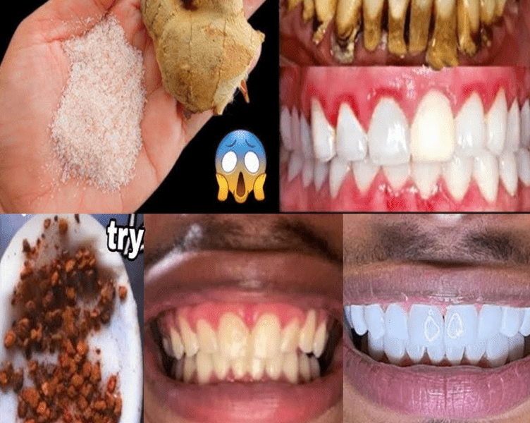 The Surprising Garlic Trick for Stronger Teeth and Healthier Gums – Healthy Life