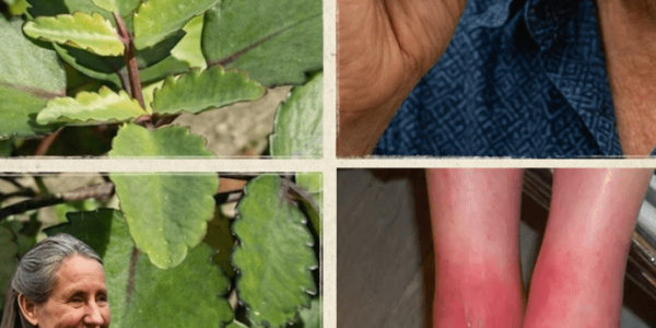 The “Miracle Leaf” in Your Garden You’ve Been Overlooking – Healthy Life