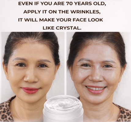 A Gentle Way to Smooth Wrinkles and Fade Dark Spots – Health