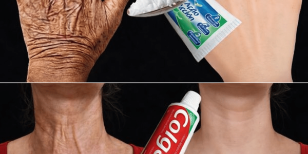 The At-Home Remedy People Are Using to Improve the Appearance of Wrinkles and Dark Spots on Hands and Arms – Health