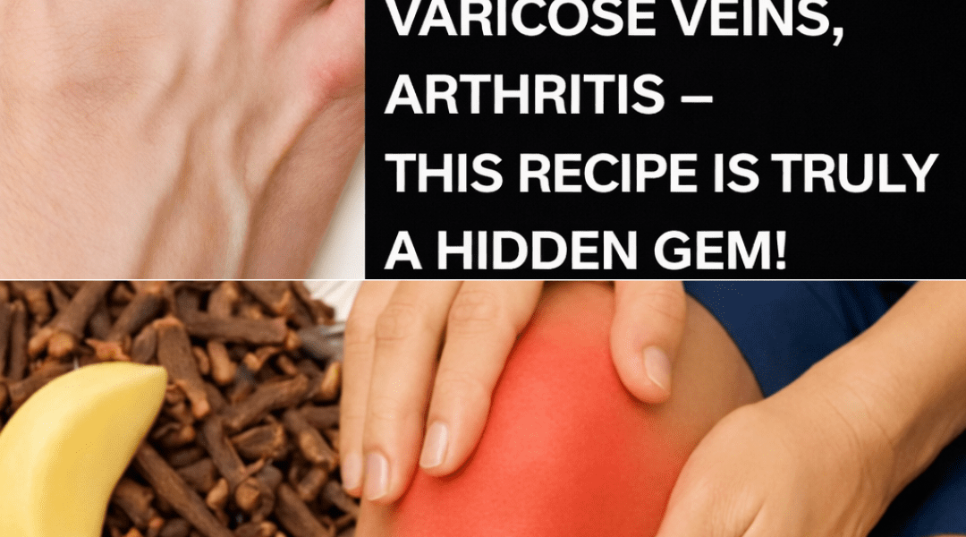 Natural Relief for Muscle Pain, Joint Inflammation, and Poor Circulation Using Garlic, Cloves, and Ginger – Health