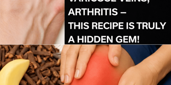 Natural Relief for Muscle Pain, Joint Inflammation, and Poor Circulation Using Garlic, Cloves, and Ginger – Health