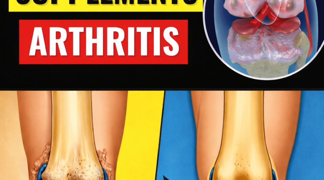 Ease Arthritis and Knee Pain With These Powerful Foods – Health