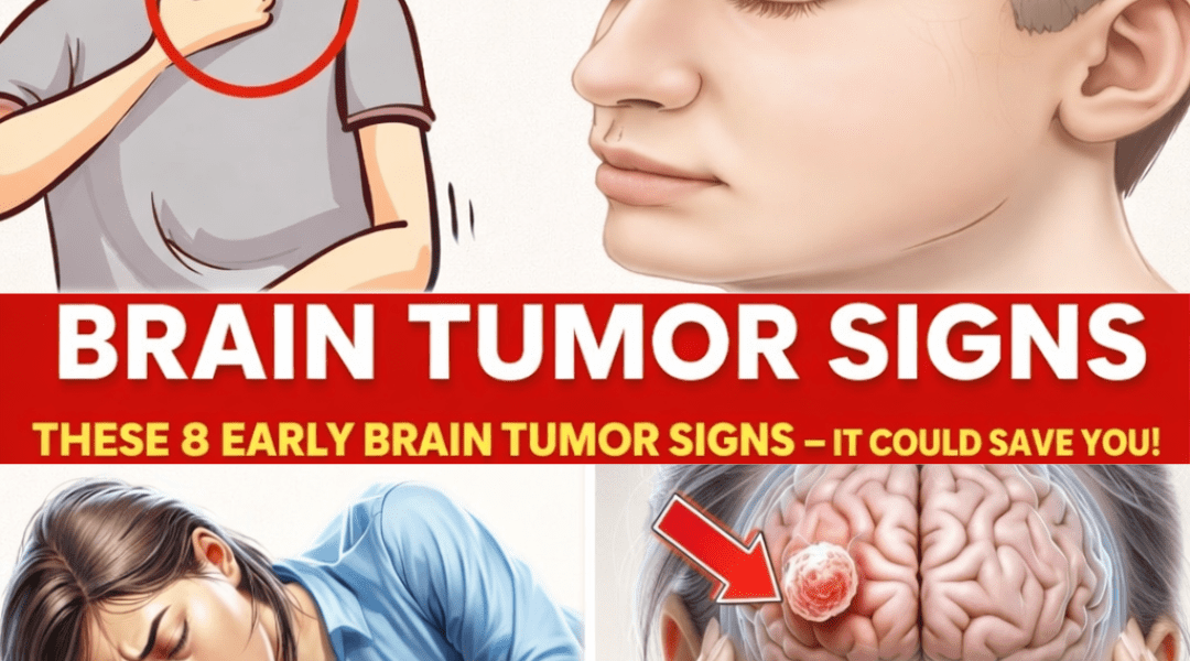 Don’t Miss These 8 Early Signs of a Brain Tumor – Early Detection Can Make a Difference – Health